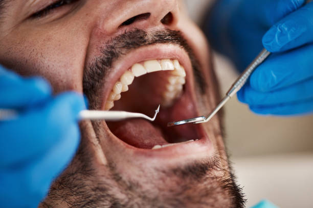 Best Laser Dentistry  in Laverne, OK